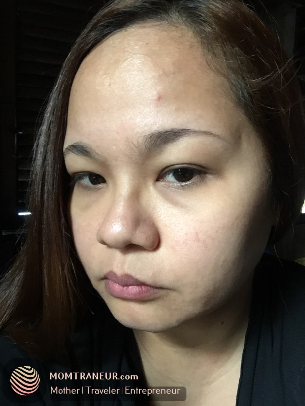 pimply, scaly, dry face