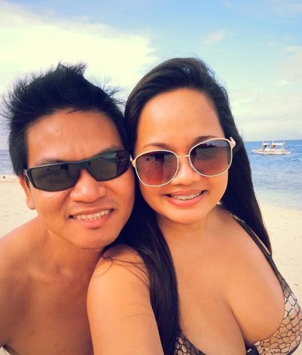 Braces at 35 years old